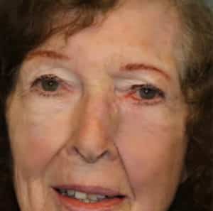 Face Reconstruction